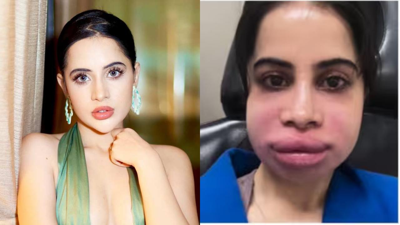 Uorfi Javed looks unrecognisable as she dissolves her lip fillers: 'Doctors with fancy clinics know nothing'